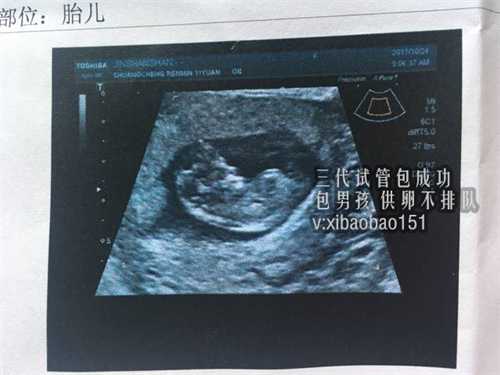 包成功代生儿子保密咨询,天津有女生愿意代孕吗,放开单身女性试管婴儿限制