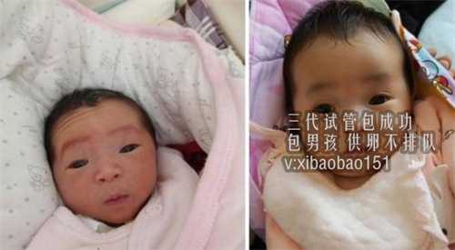 青岛哪里需要精子,2022天津市中心妇产科医院三代试管婴儿生男孩费用一览
